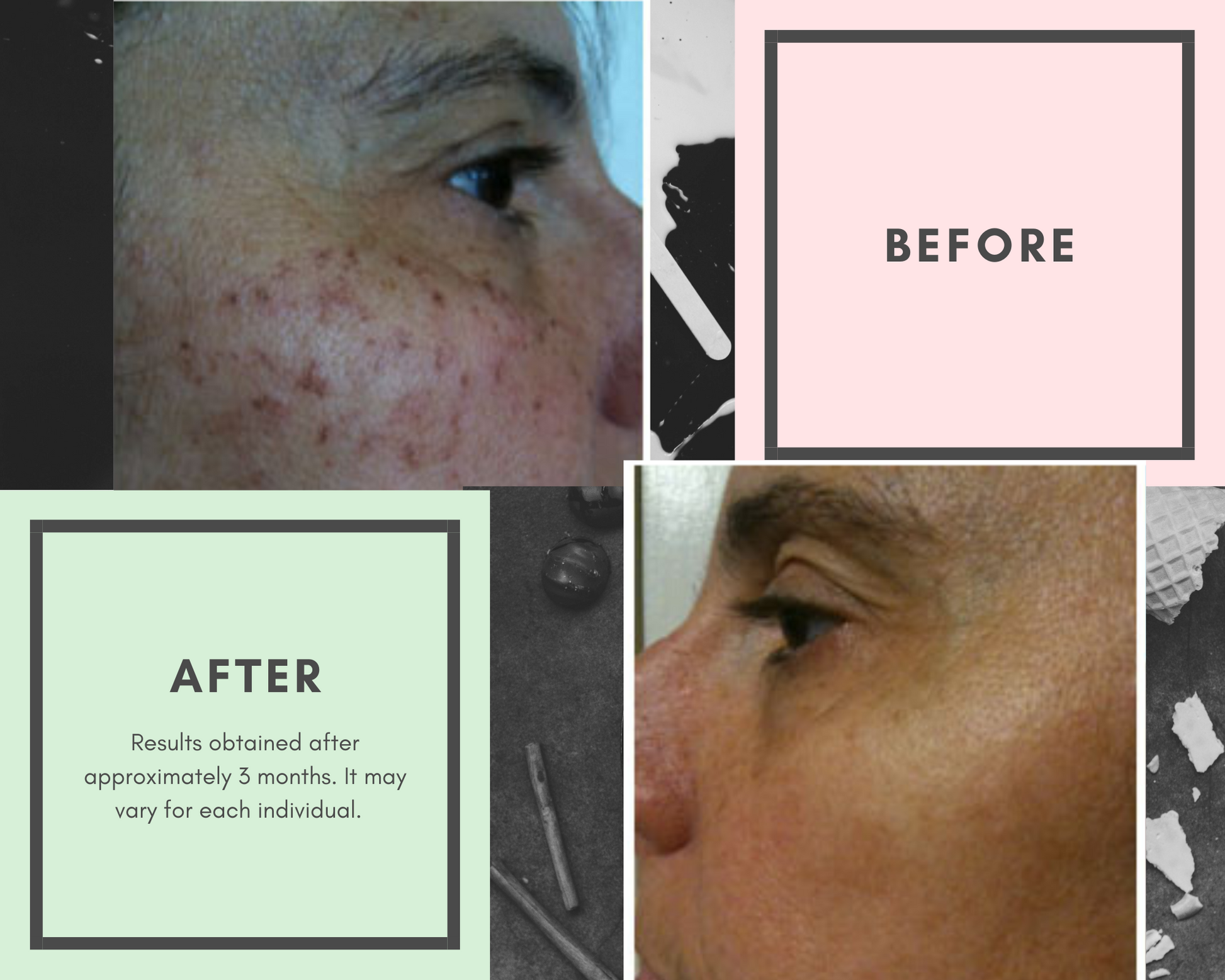 Pigmentation Control Balm / Whitening Crème | ALOE AGELESS™